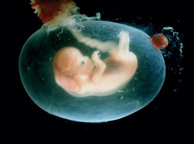 Caso de adolescente dominicana embarazada y enferma de leucemia revive debate sobre el aborto Caso de adolescente dominicana embarazada y enferma de leucemia revive debate sobre el aborto