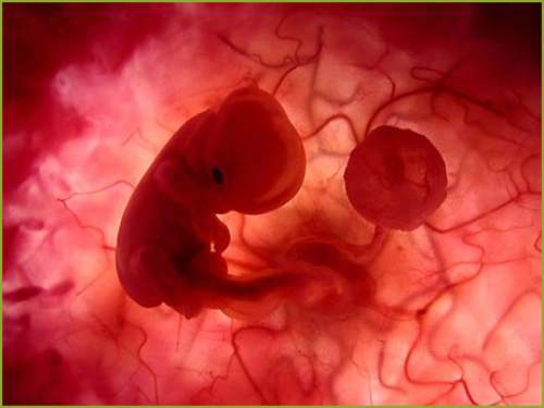 Uruguay se suma a los pocos países latinoamericanos que optaron por despenalizar el aborto Uruguay se suma a los pocos países latinoamericanos que optaron por despenalizar el aborto