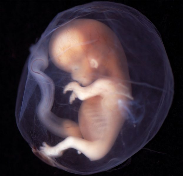 La prohibición del aborto como dique de contención La prohibición del aborto como dique de contención