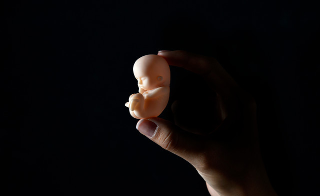 Cadem: 71 % de los chilenos aprueba la despenalización del aborto Cadem: 71 % de los chilenos aprueba la despenalización del aborto