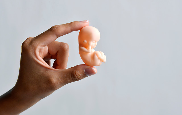 Estudio Injuv: 60% de los jóvenes están a favor de la legalización del aborto Estudio Injuv: 60% de los jóvenes están a favor de la legalización del aborto