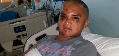 Movilh denuncia violento ataque a joven transexual en Temuco Movilh denuncia violento ataque a joven transexual en Temuco