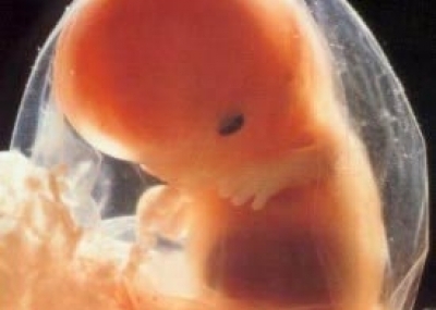 DC busca postergar votación del proyecto de aborto terapéutico DC busca postergar votación del proyecto de aborto terapéutico