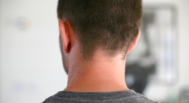 Lanzan campaña para prevenir y detectar a tiempo el cáncer de cabeza y cuello Lanzan campaña para prevenir y detectar a tiempo el cáncer de cabeza y cuello