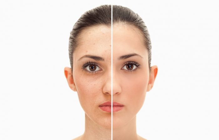 El tratamiento de belleza de las modelos de Elite para lograr un rostro resplandeciente El tratamiento de belleza de las modelos de Elite para lograr un rostro resplandeciente