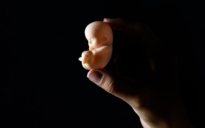 Aborto: este no es un tema 