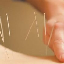 La acupuntura como alternativa para tratar las molestias alergias
