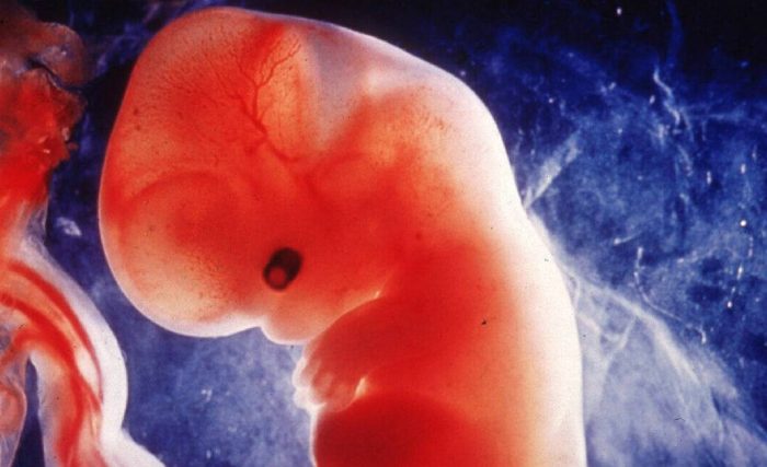 85% aprueba aborto en caso de violación y la mayoría cree que la Iglesia es su principal opositor seguida por la derecha 85% aprueba aborto en caso de violación y la mayoría cree que la Iglesia es su principal opositor seguida por la derecha