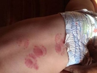 Junji ante caso de niño mordido: «Estos jardines no deberían existir» Junji ante caso de niño mordido: