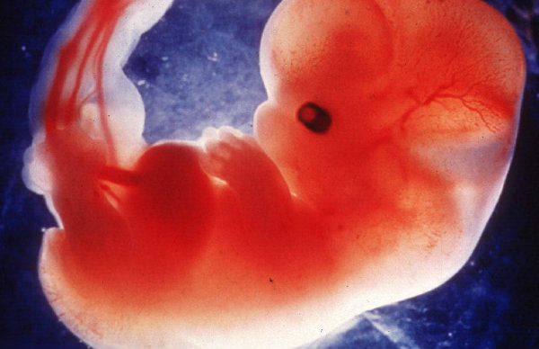 El aborto por violación y el ejercicio ilegítimo de la fuerza del Estado El aborto por violación y el ejercicio ilegítimo de la fuerza del Estado