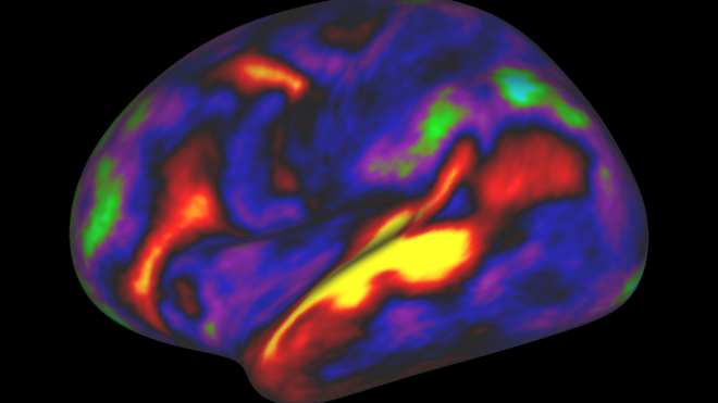 El increíble hallazgo de 97 zonas que no se conocían del cerebro El increíble hallazgo de 97 zonas que no se conocían del cerebro