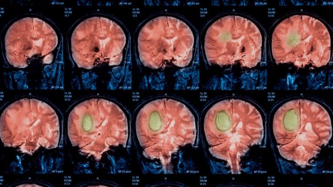 Científicos concluyen que resultados de escáneres cerebrales acumulan 15 años de errores Científicos concluyen que resultados de escáneres cerebrales acumulan 15 años de errores