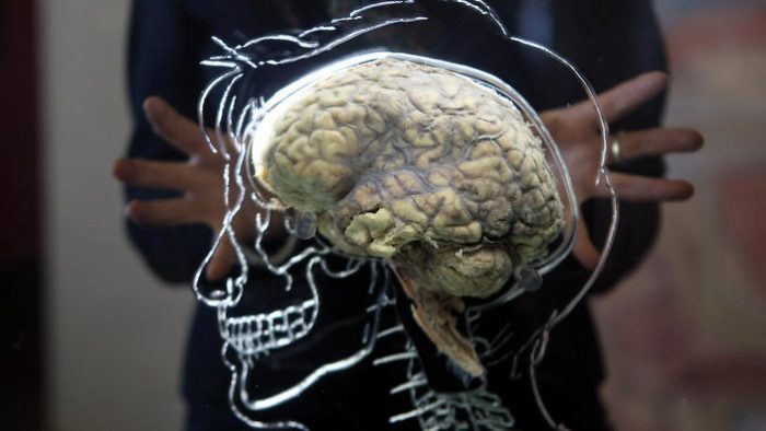Hallazgos sobre conectividad cerebral permitirán ayudar a pacientes con demencias Hallazgos sobre conectividad cerebral permitirán ayudar a pacientes con demencias