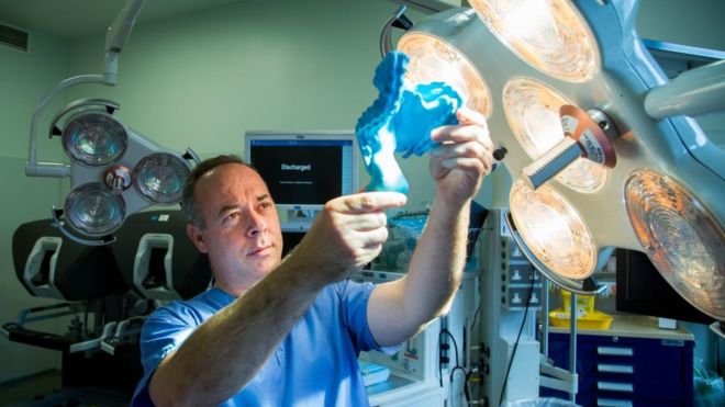 ¿Qué es y dónde está el mesenterio, el «nuevo órgano» del cuerpo humano identificado por los científicos? ¿Qué es y dónde está el mesenterio, el