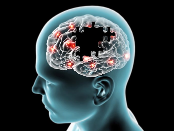 Con ejercicio de realidad virtual científicos estudian signos precoces del Alzheimer Con ejercicio de realidad virtual científicos estudian signos precoces del Alzheimer