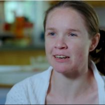 [VIDEO] El extraordinario caso de una mujer que le extirparon medio cerebro porque sufría encefalitis de Rasmussen