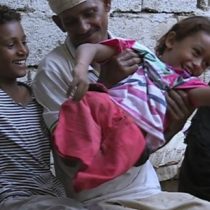 [VIDEO] Emad, el niño que se quedó sin piernas a los 4 años cuando un misil impactó en su casa de Yemen