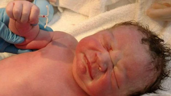 ¿Puede fallar el DIU? Caso de bebé que nació a pesar que la madre llevaba pocos meses con él, abrió el debate