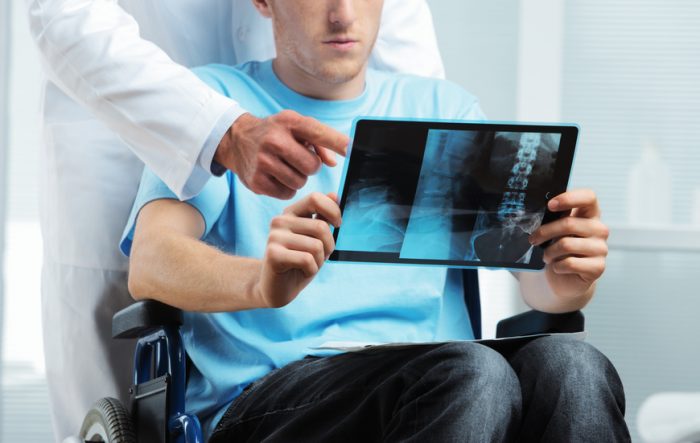 Esclerosis múltiple, una enfermedad con difícil diagnóstico y muy costosa Esclerosis múltiple, una enfermedad con difícil diagnóstico y muy costosa