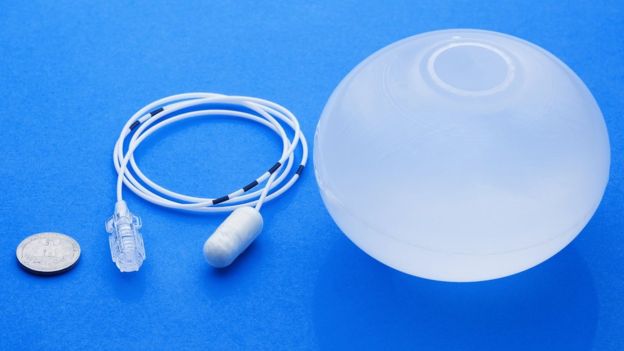El globo gástrico que no necesita cirugía y con el que los obesos pueden perder 12 kg en 3 meses El globo gástrico que no necesita cirugía y con el que los obesos pueden perder 12 kg en 3 meses
