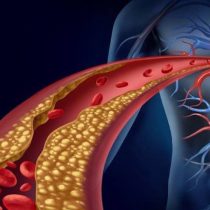 Algoritmo de matemático chileno evita exámenes invasivos al corazón y las arterias
