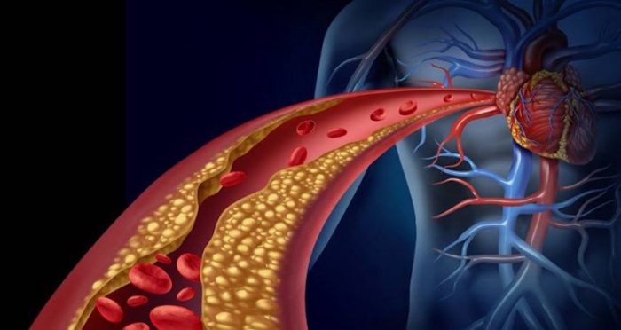 Algoritmo de matemático chileno evita exámenes invasivos al corazón y las arterias