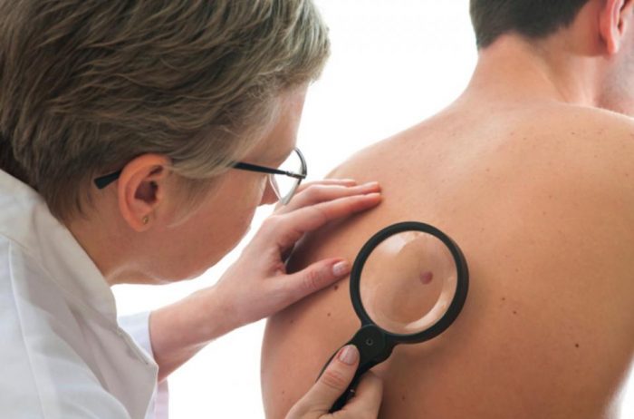 ¿Por qué los adultos mayores son más propensos a sufrir cáncer de piel? ¿Por qué los adultos mayores son más propensos a sufrir cáncer de piel?
