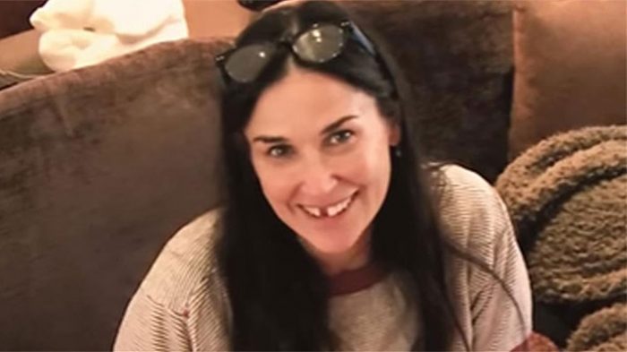 Demi Moore perdió dos dientes por estrés ¿Es algo común? Demi Moore perdió dos dientes por estrés ¿Es algo común?