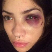 Valentina Henríquez, ex polola del líder de Los Tetas, habla tras viralización de su denuncia de violencia: “Temo aún”