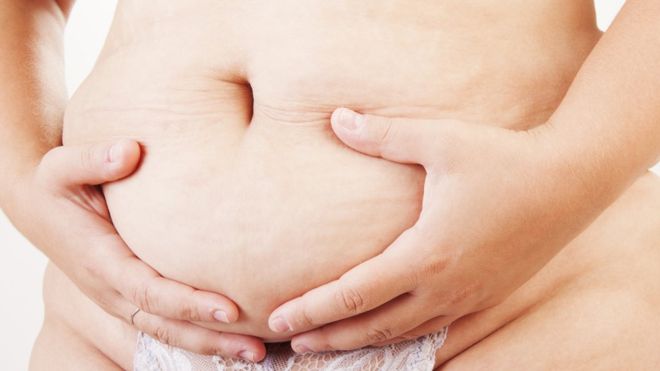 Qué causa la “barriga de mamá” de la que muchas mujeres no consiguen deshacerse y cómo se puede combatir Qué causa la “barriga de mamá” de la que muchas mujeres no consiguen deshacerse y cómo se puede combatir