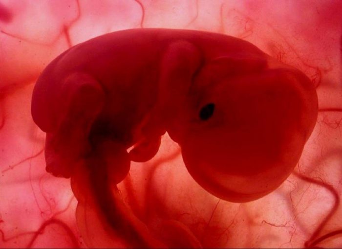 La omisión del padre en la Ley de Aborto La omisión del padre en la Ley de Aborto