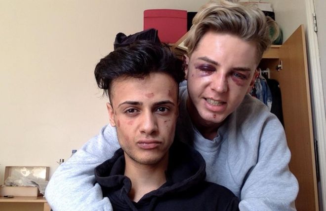 “Casi me dejaron ciego por escoger a la persona que amo”: el dramático relato de parejas gay que fueron brutalmente atacadas “Casi me dejaron ciego por escoger a la persona que amo”: el dramático relato de parejas gay que fueron brutalmente atacadas