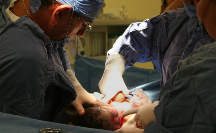 Chile es uno de los países que lidera partos por cesárea a nivel latinoamericano