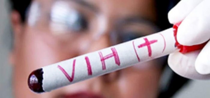 Explosión del VIH en Chile: una enfermedad a la que se le perdió el respeto