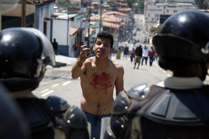 ONU denuncia tortura y el uso generalizado y sistemático de la fuerza excesiva en Venezuela ONU denuncia tortura y el uso generalizado y sistemático de la fuerza excesiva en Venezuela