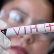 VIH también se dispara en sector privado: isapres registran mil casos nuevos por año