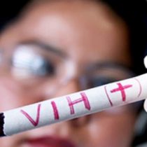 VIH Sida: más de 30 por ciento de los casos confirmados en enero de 2018 corresponden a inmigrantes