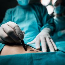 ¿Es la Cirugía Bariátrica la solución para la obesidad mórbida?