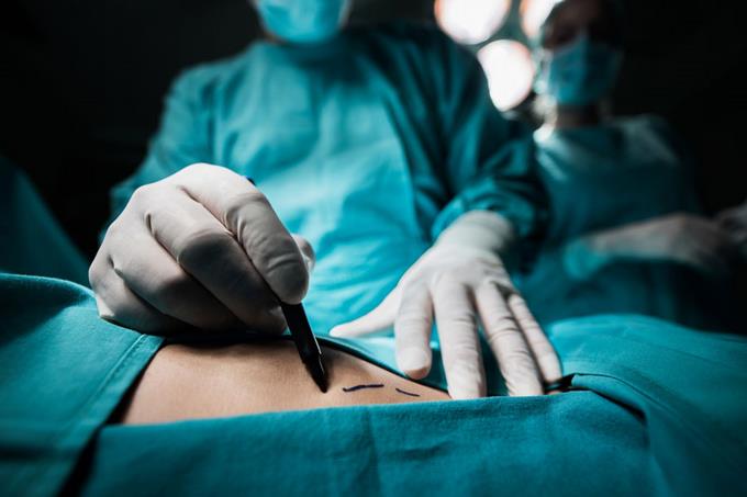 ¿Es la Cirugía Bariátrica la solución para la obesidad mórbida? ¿Es la Cirugía Bariátrica la solución para la obesidad mórbida?