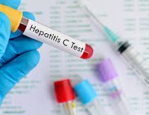Hepatitis C en la Atención Primaria