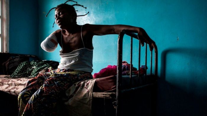 “Estaban decapitando personas, tuve que trepar sobre cadáveres para huir”: el desgarrador testimonio de sobrevivientes de las masacres en República Democrática del Congo