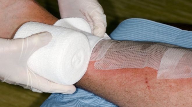 Por qué las heridas que ocurren de día se curan más pronto que las que ocurren en la noche Por qué las heridas que ocurren de día se curan más pronto que las que ocurren en la noche