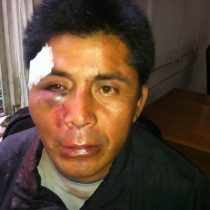 Justicia formaliza a carabinero por apremios ilegítimos contra comunero mapuche en 2014