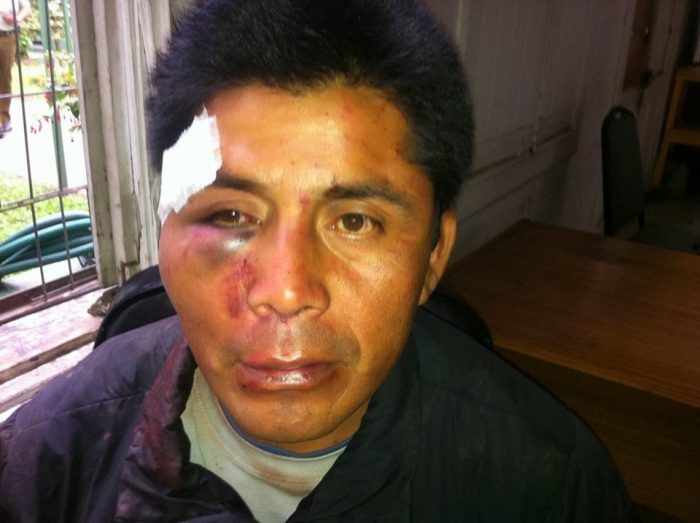 Justicia formaliza a carabinero por apremios ilegítimos contra comunero mapuche en 2014 Justicia formaliza a carabinero por apremios ilegítimos contra comunero mapuche en 2014