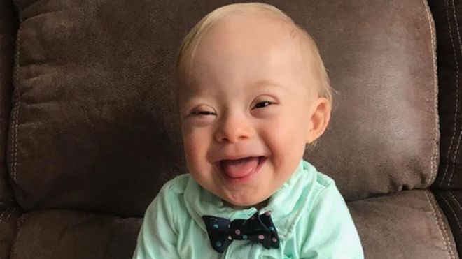Lucas Warren, el bebé con síndrome de Down que será el rostro de la marca de comida para niños Gerber Lucas Warren, el bebé con síndrome de Down que será el rostro de la marca de comida para niños Gerber