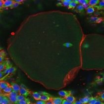 Crean los primeros óvulos humanos de laboratorio, un esperanzador avance para preservar la fertilidad de niñas sometidas a tratamientos contra el cáncer