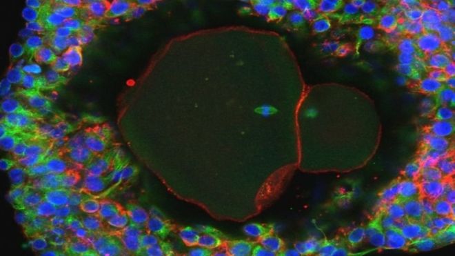 Crean los primeros óvulos humanos de laboratorio, un esperanzador avance para preservar la fertilidad de niñas sometidas a tratamientos contra el cáncer Crean los primeros óvulos humanos de laboratorio, un esperanzador avance para preservar la fertilidad de niñas sometidas a tratamientos contra el cáncer