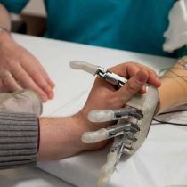 Crean método para restaurar sensación de movimiento en pacientes amputados