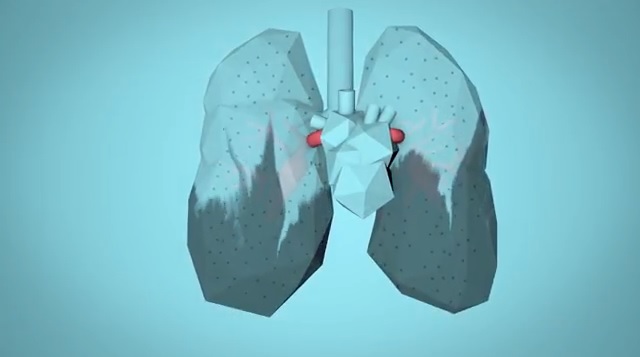 Cómo la contaminación del aire afecta a tu cuerpo