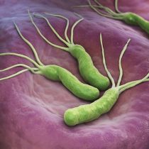 Promueven método de detección no invasivo para Helicobacter Pylori